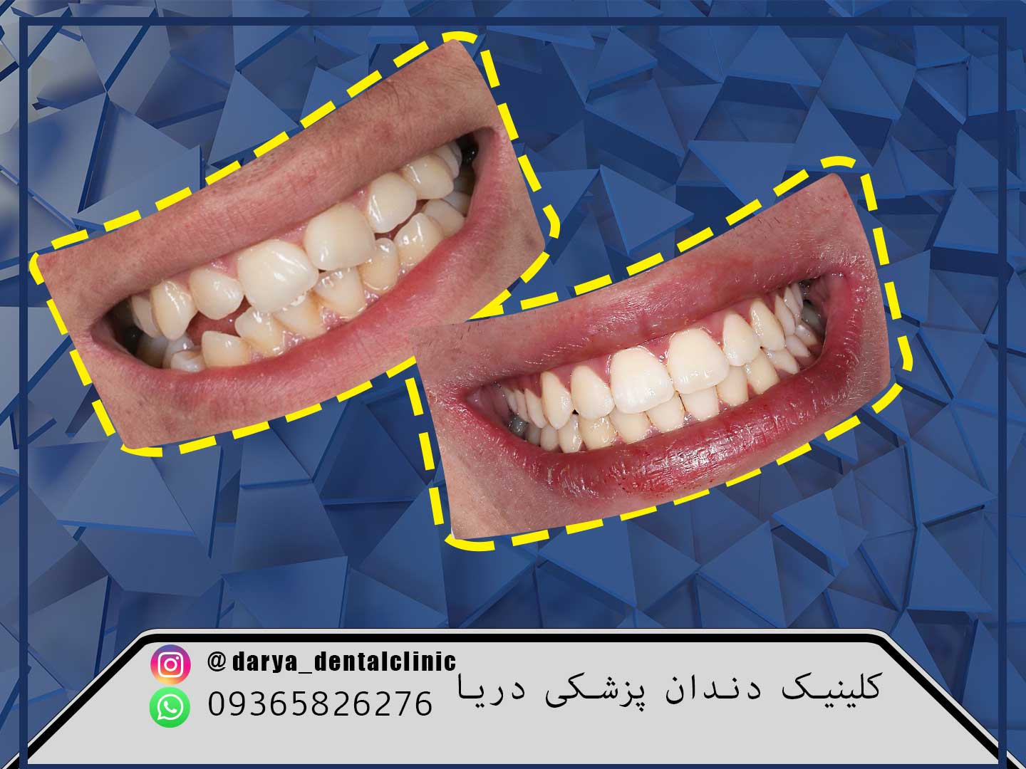 ارتودنسی دندان در کرج (جهانشهر )