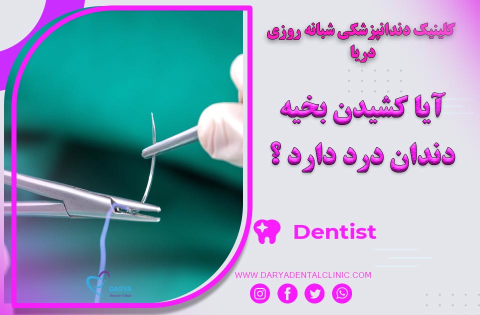 آیا کشیدن بخیه دندان درد دارد ؟