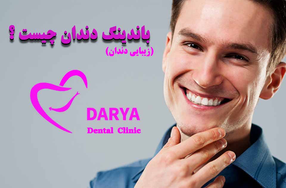 باندینگ دندان چیست ؟ همه چیز درباره باندینگ