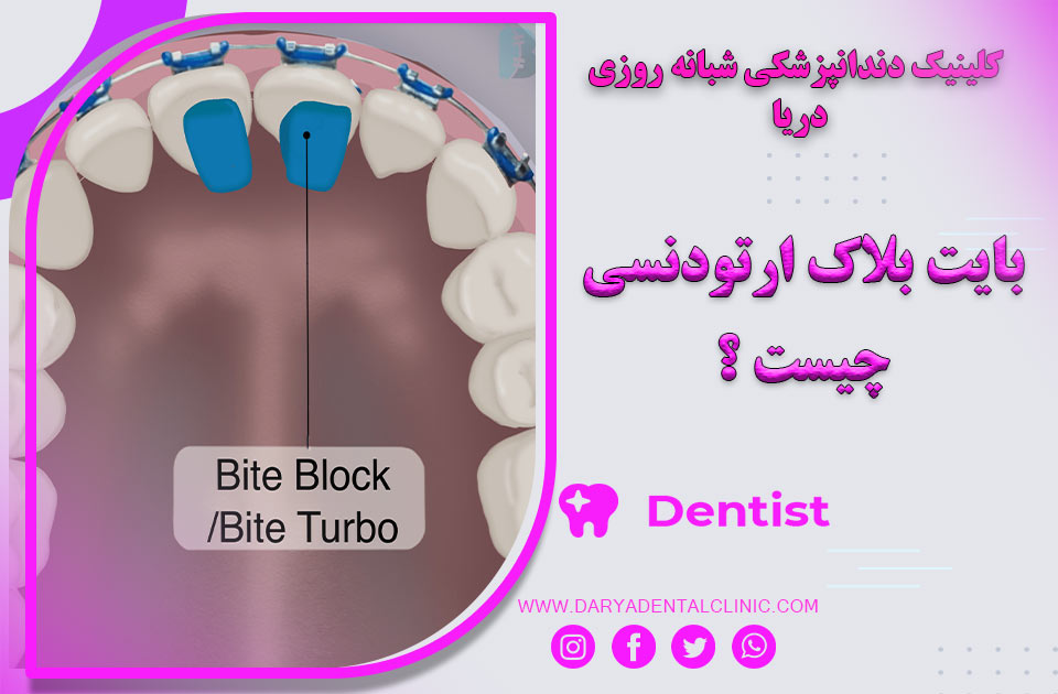 بایت بلاک دندان چیست ؟