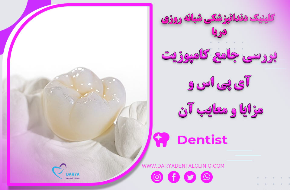 بررسی جامع کامپوزیت  IPSو مزایا و معایب آن