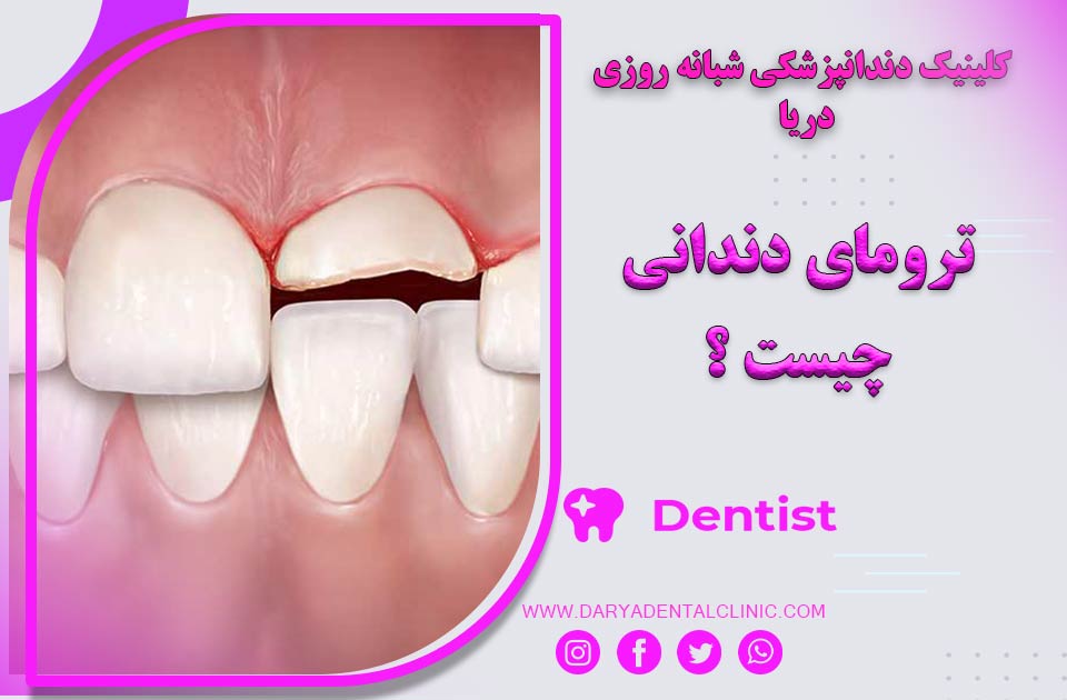 ترومای دندان چیست ؟