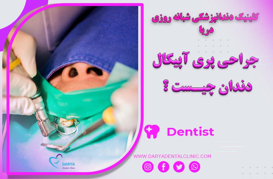 جراحی پری آپیکال دندان چیست ؟