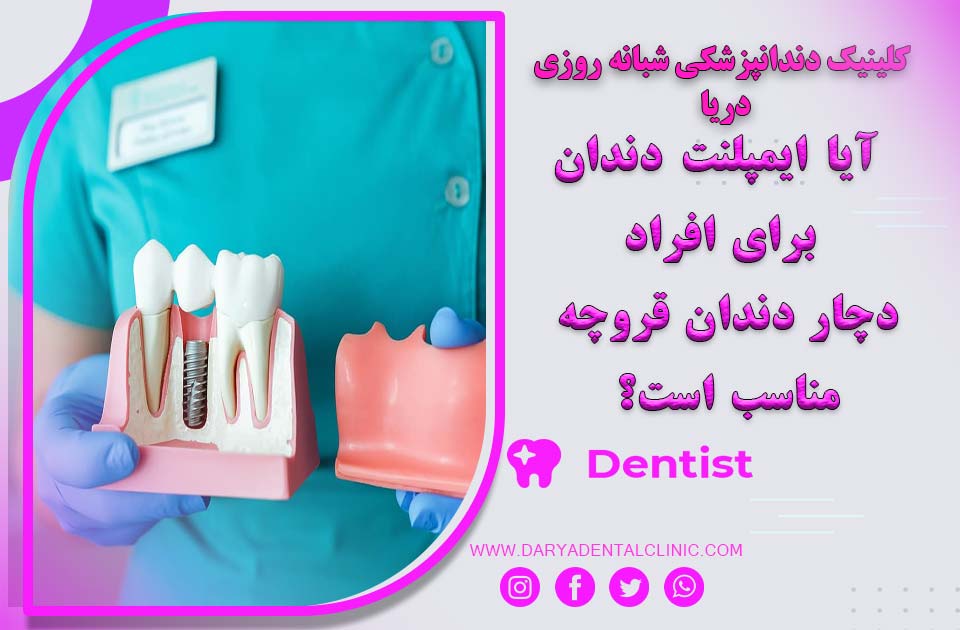 آیا ایمپلنت دندان برای افراد دچار دندان قروچه مناسب است؟