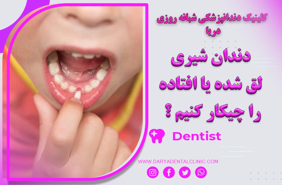 دندان شیری لق شده یا افتاده را چیکار باید کرد ؟