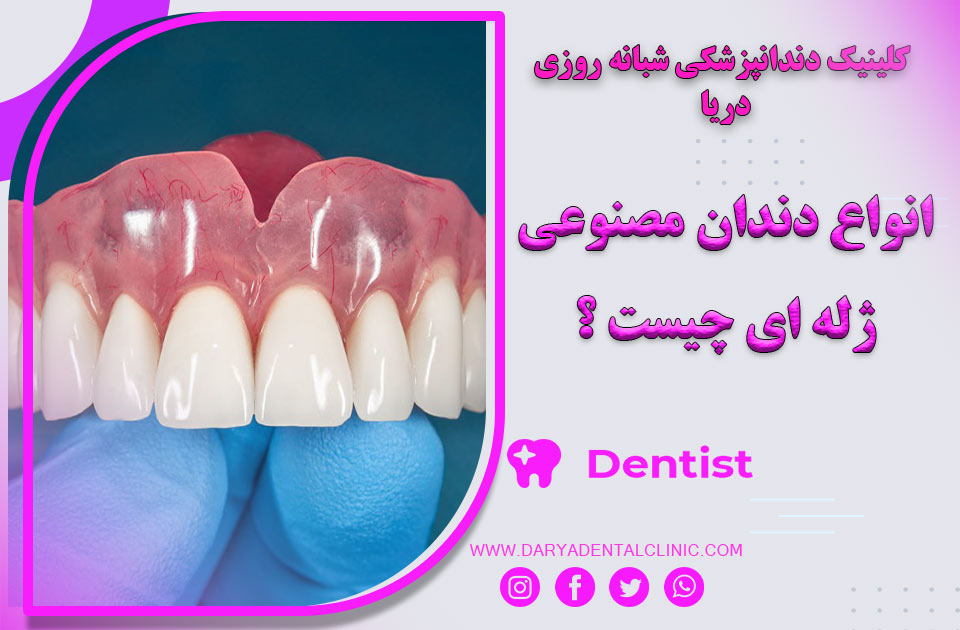 انواع دندان مصنوعی ژله ای کدام اند ؟