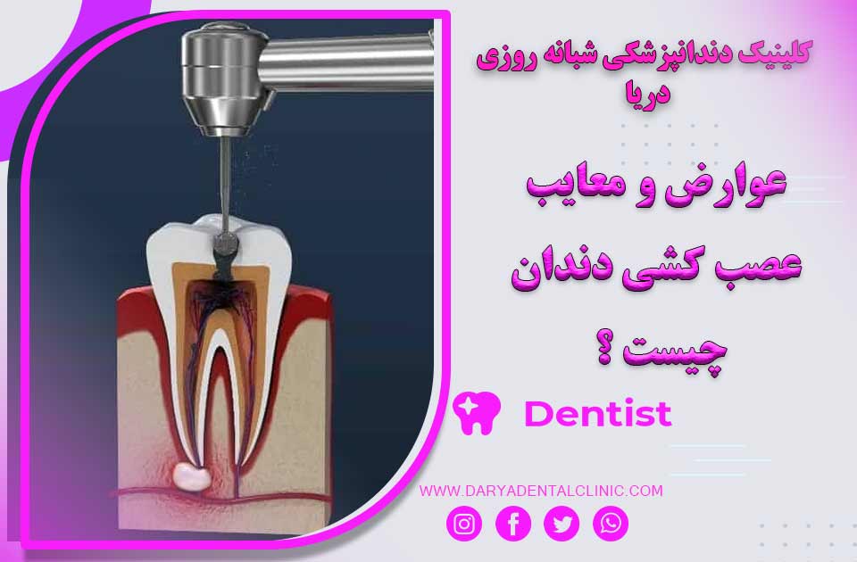 عوارض و معایب عصب کشی دندان چیست ؟
