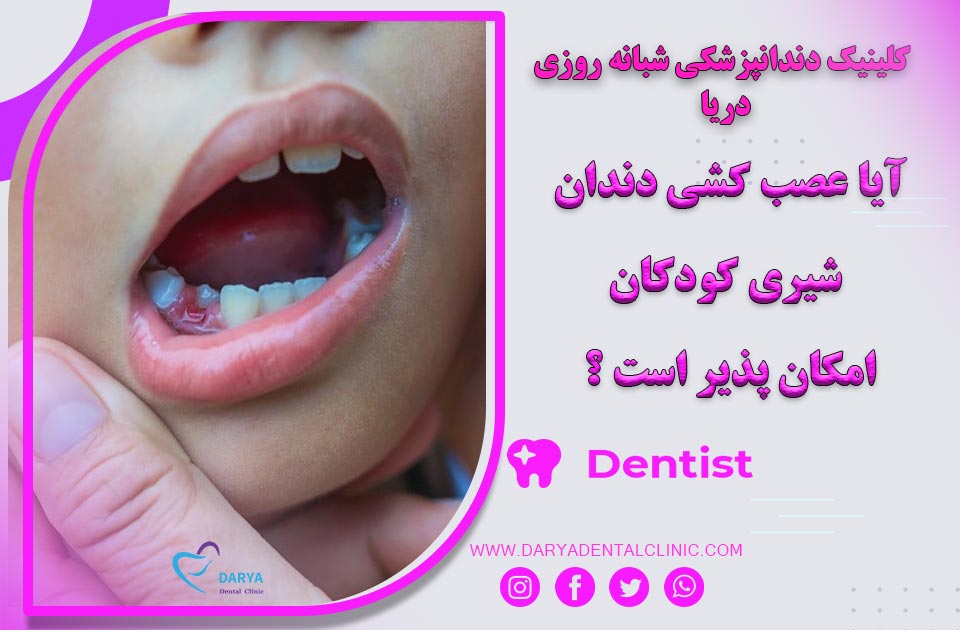 آیا عصب کشی دندان شیری کودکان امکان پذیر است ؟