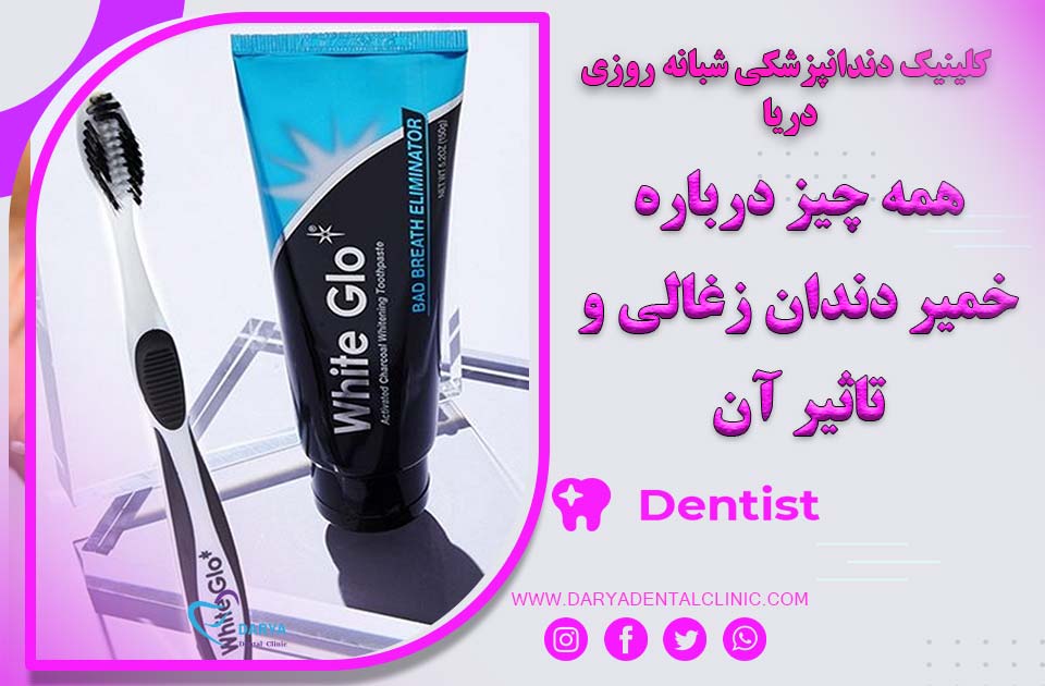 همه چیز درباره خمیر دندان زغالی و تاثیر آن