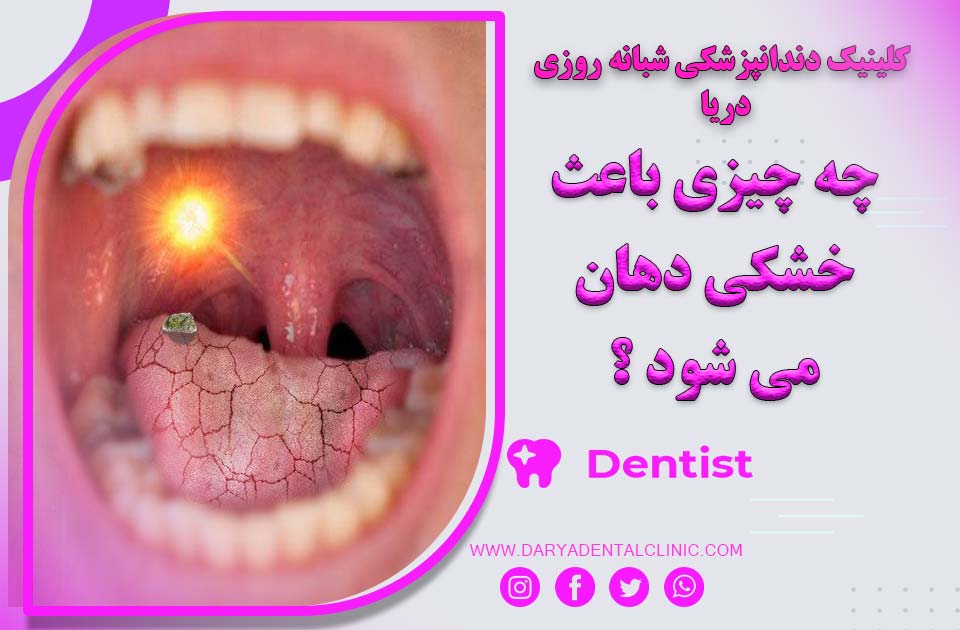 چه چیزی باعث خشکی دهان می شود ؟ درمان و علل آن