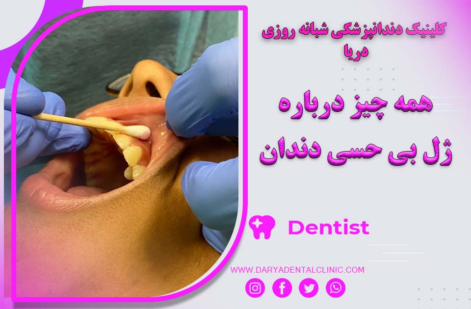 همه چیز درباره ژل بی حسی دندان