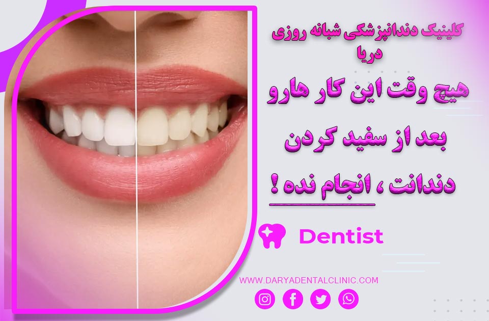 هیچ وقت این کار هارو بعد از سفید کردن دندانت انجام نده !