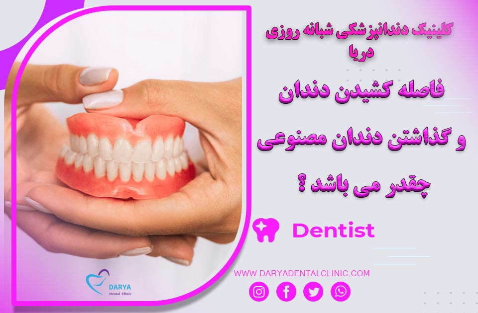 فاصله کشیدن دندان و گذاشتن دندان مصنوعی چقدر می باشد ؟